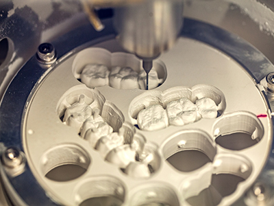 Stoughton Dentistry | Extractions, Preventative Program and Dental Lab