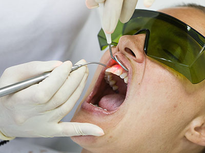 Stoughton Dentistry | TMJ Disorders, Dental Fillings and Air Abrasion