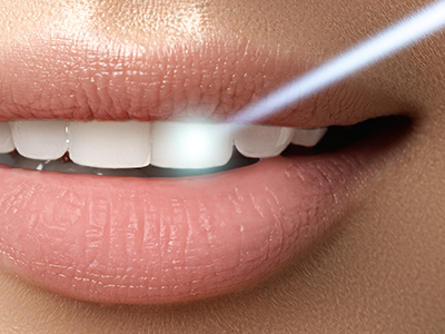 Stoughton Dentistry | Digital Radiography, CBCT and Teeth Whitening